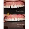 Buy cheap Say Hello To A Flawless Smile With Cosmetic Dental Veneers No Discoloration No from wholesalers