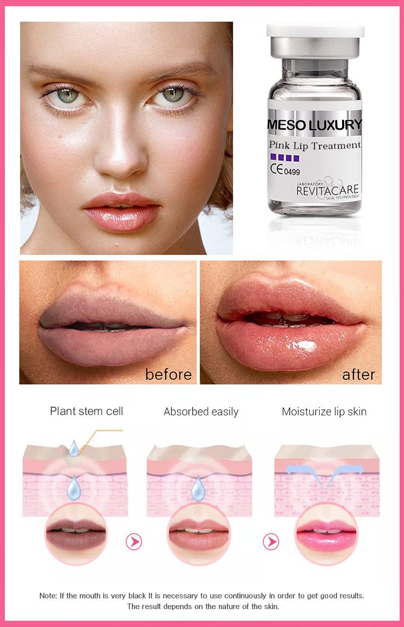 Pink Luxury Vitamin C Lip Serum Meso Organic Treatment Lip Brightening Serum
