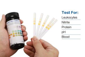 China Glucose Protein Urine Ph Strips MSDS Approved on sale