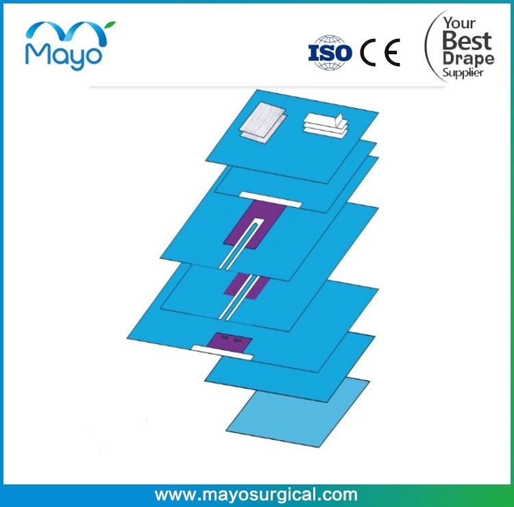 Customized Surgical Universal Orthopaedic Drape Pack With CE ISO