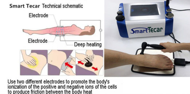 80mm Handdle Smart Tecar Therapy Machine For Knee Shoulder Pain