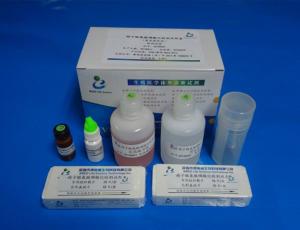 China 40T/Kit Sperm Function Test Kit For Determinate Protein Tyrosine Phosphorylation on sale