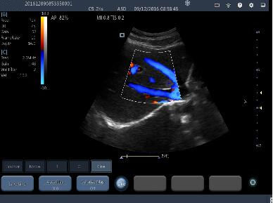 Portable Ultrasound Machine Probes Wireless Ultrasound Probe with 2~11MHz Frequency 160g Weight Only