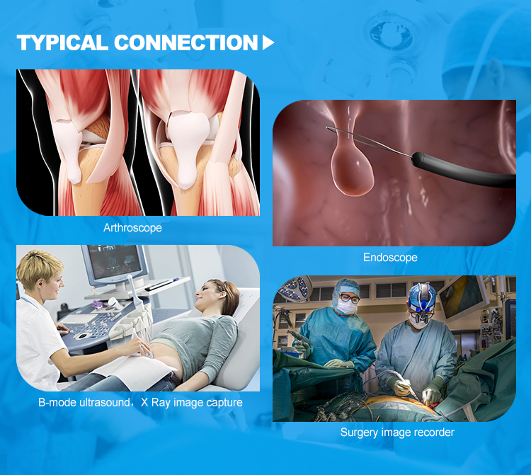 Hospital Medical Video Recorder For Endoscope Arthroscopy Ultrasound