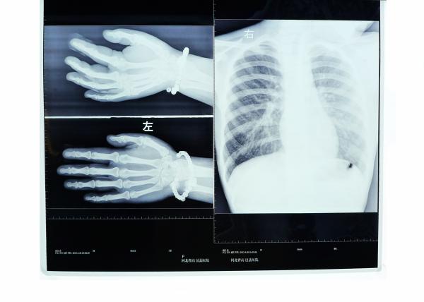 10 x 14inch Dry Medical X Ray Films For Fuji 3000 / 2000 / 1000