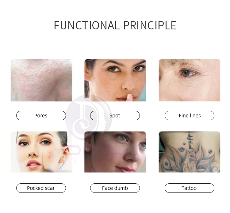 Q Switched Nd Yag Lazer Tattoo Removal Picolaser Carbon Laser Peel Laser Machine For Pigmentation Removal Skin Rejuvenation
