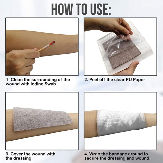 alginate fabric surgical dressing with silver