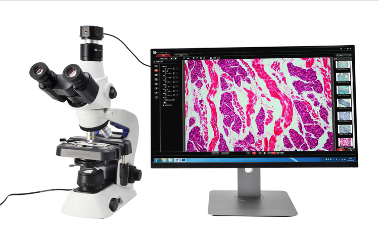ccd camera for microscope