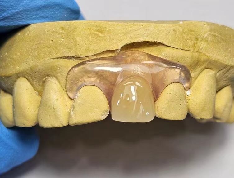 Dental TCS Valplast Flexible Partial Dentures Staining Fading Odors Resistant