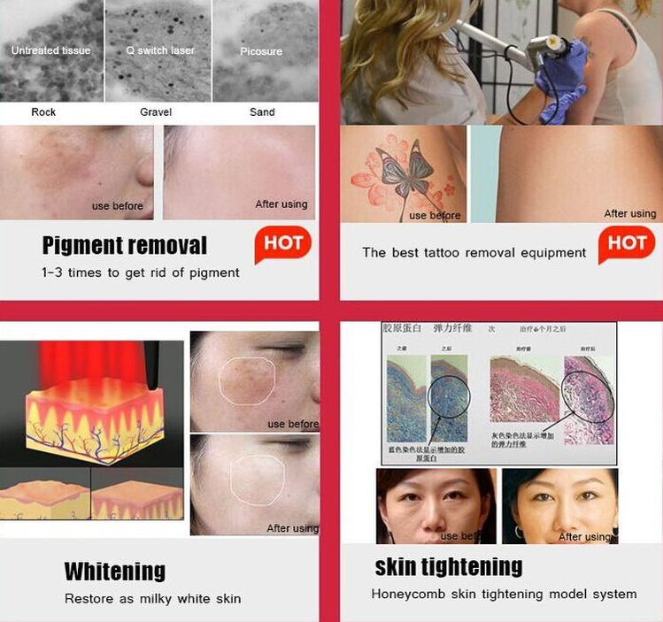 755nm Honeycomb Yag Laser Tattoo Removal Machine , Stationary Nd Yag Laser Picosecond