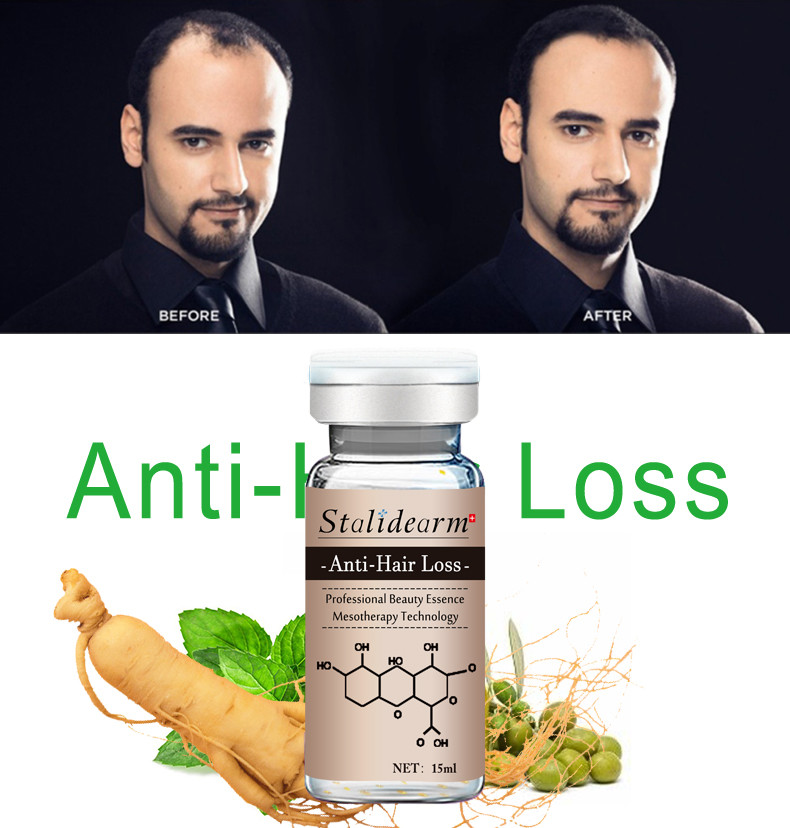 10ml Anti Hair Loss Serum Plant Ingredient Natural Hair Growth Serum Microneedling