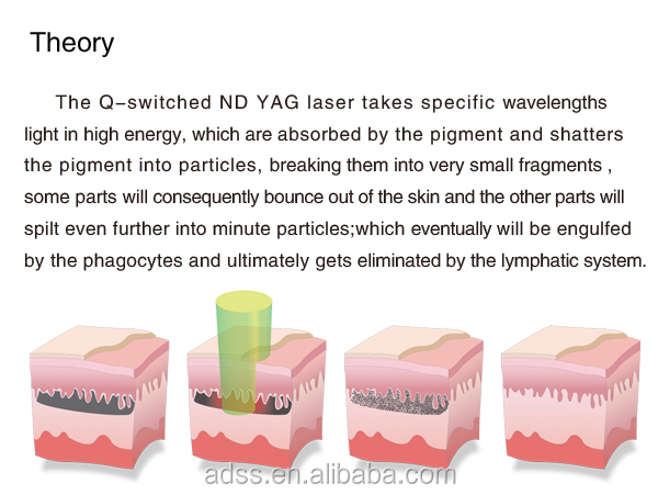 OEM / ODM Q Switch Yag Laser Tattoo Removal Machine 2 Years Warranty