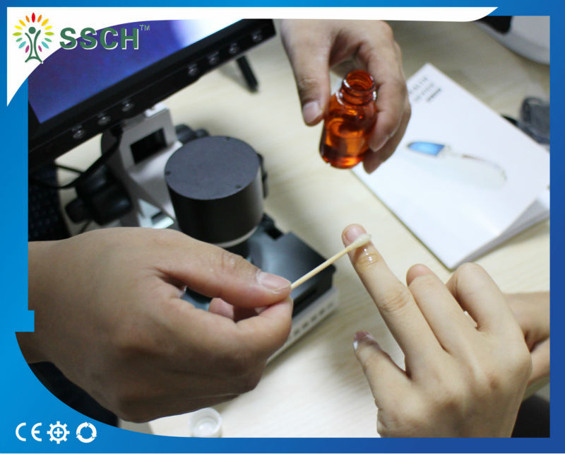 CE Approved LCD Screen Medical Microscope Capillary Microcirculation
