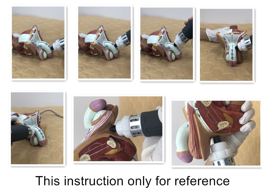 4 Handles Type Extracorporeal Shock Wave Therapy Machine , Cryolipolysis Machine For Home Use
