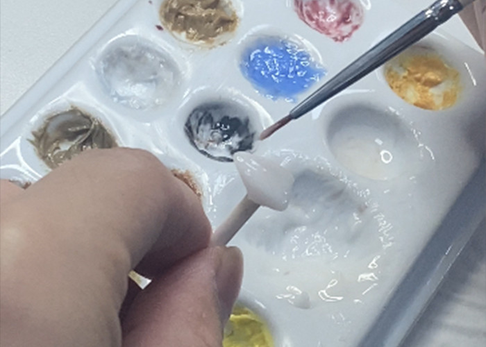 Porcelain EMAX Veneer High Precision Esthetic Restorations with Superior Durability