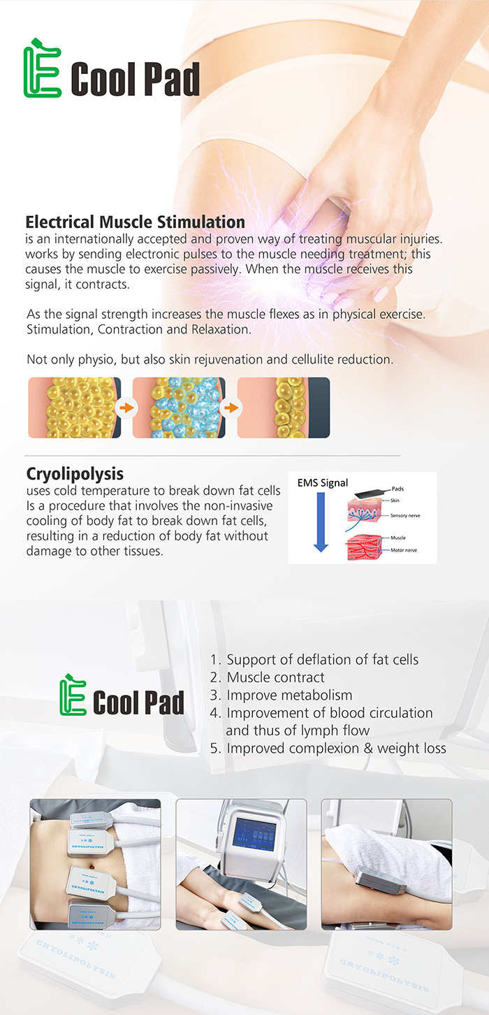Non Vacuum Cryolipolysis Fat Freezing Machine With 4 Flat Handles High Efficiency