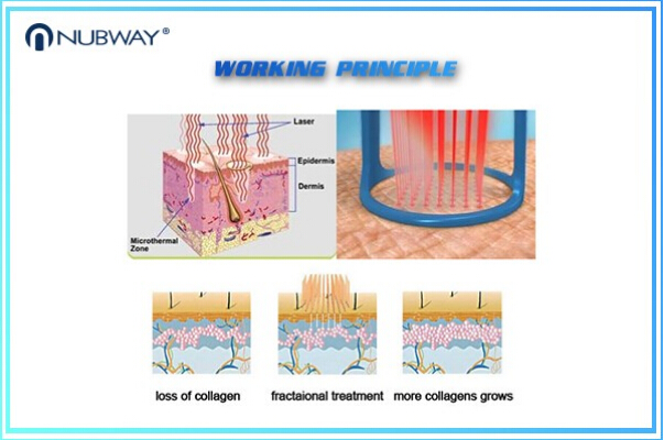 30w Fractional Co2 Laser Nubway Products Vaginal Applicator