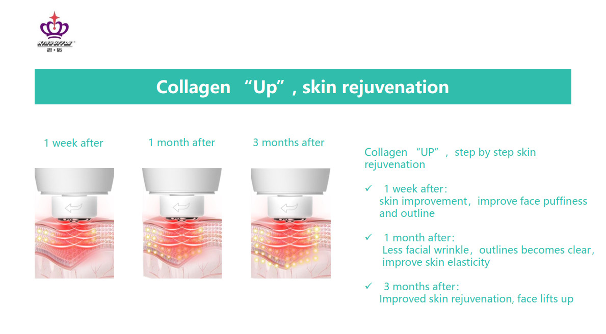3.5H Removal Acne 10W Radio Frequency Beauty Instrument