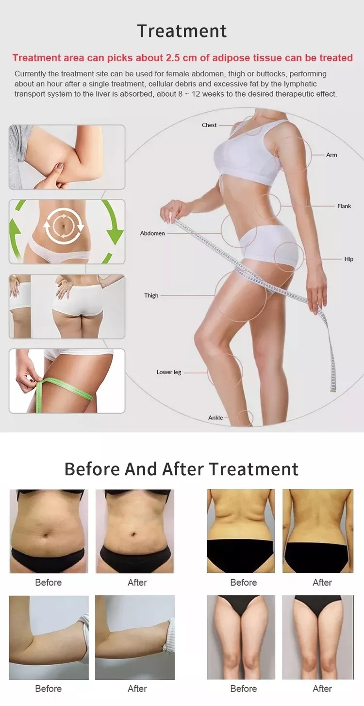 Advanced 5Mhz Rf Frequency Slimming Machine with 50r/min Roller Speed
