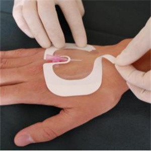 5*6cm Waterproof Transparent Dressing Sterile Adhesive Pads For Wounds