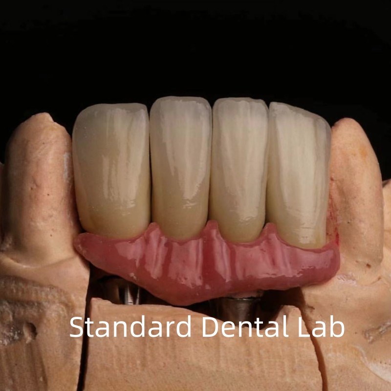 Dental Porcelain Zirconia Implant Crown Professional High Esthetics