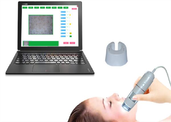 Smart Video Dermatoscope Facial Skin Camera Moisture HD Intelligent Skin
