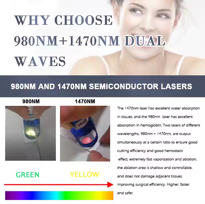 Abdomen Treatment 1470 Nm Fiber Laser Diode Machine With 1-20HZ Frequency Treatment Area