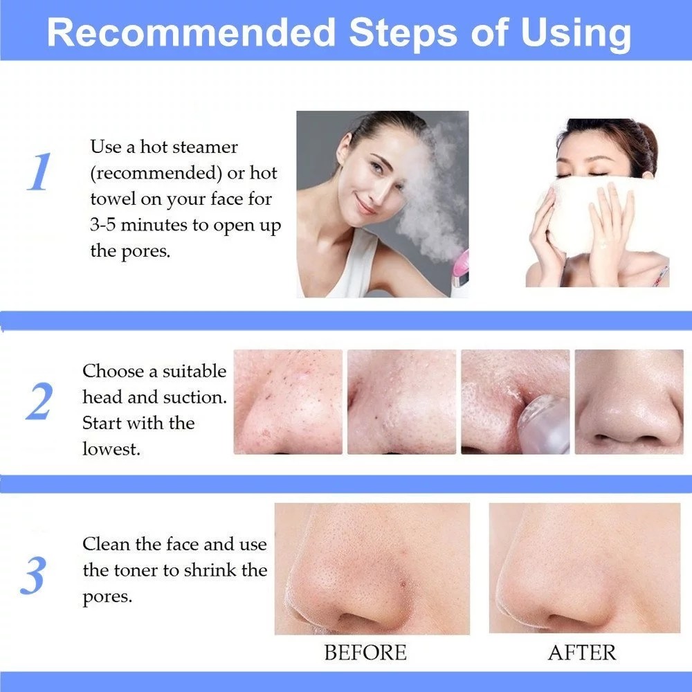 USB Charging ABS LCD Display Vacuum Blackhead Remover