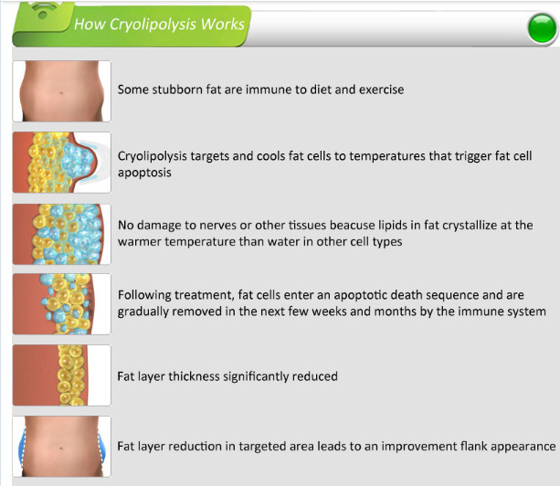 Non Surgical Liposuction Cryolipolysis Body Slimming Machine , Vacuum Weight Loss Machine