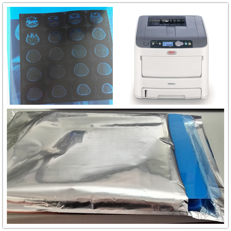 Dry Medical Imaging Blue Base A4 Sheet Inkjet Printing X-Ray Film