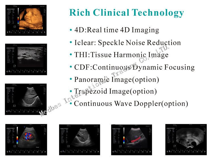 Portable Ecografo 4D Color Doppler Ultrasound Machine, Portable Echo Ultrasound Scanner