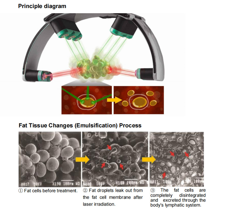 All In One 10D Slimming Roller Laser Equipment With Biolight Technology For Clinics And Spas