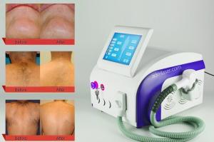  12*20mm 808nm 755nm 1064nm Laser Hair Removal Equipment Manufactures