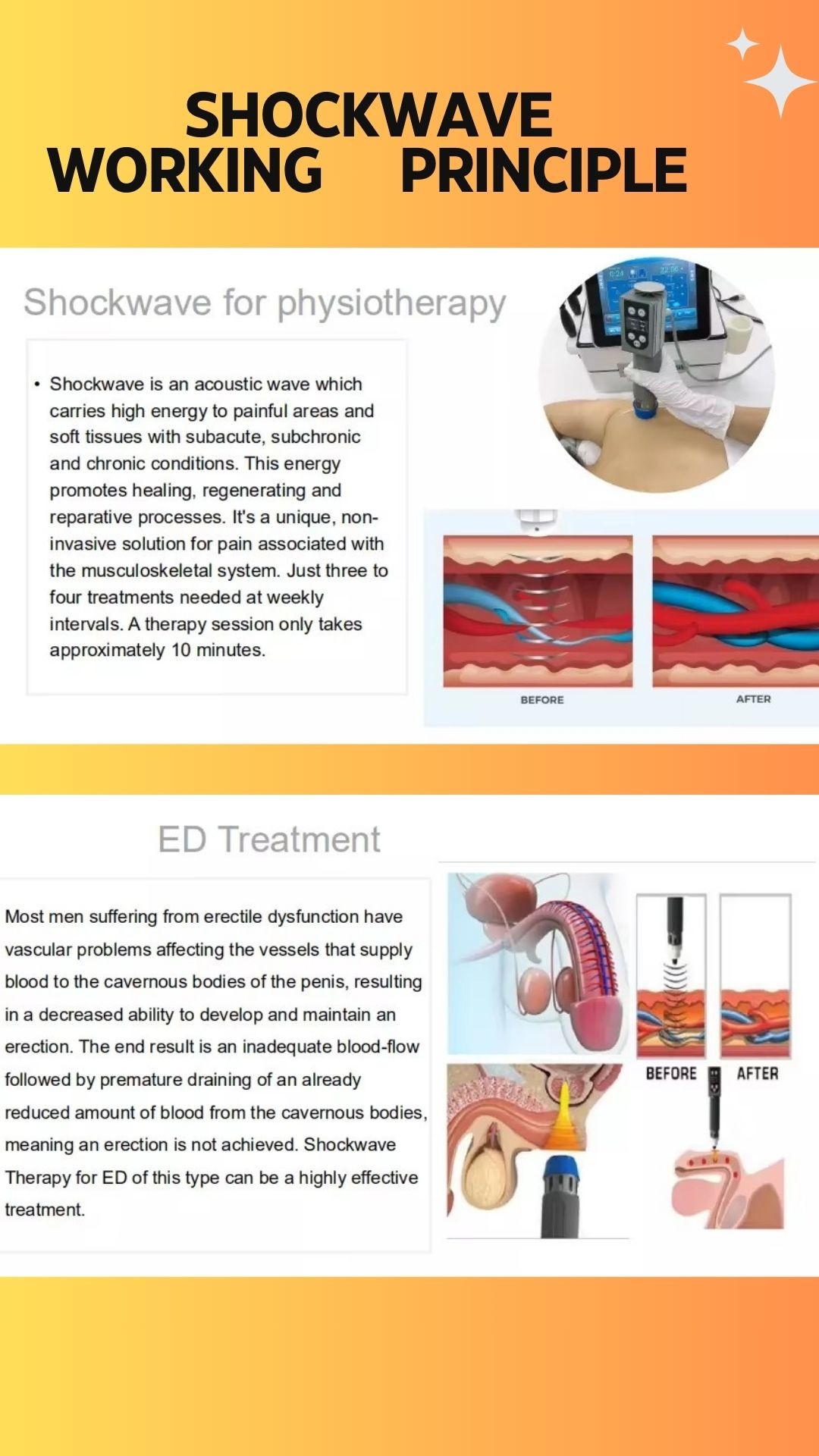 20/40/60MM Heads Size Shock Wave Device for Body Pain Relief and Tecar Diathermy