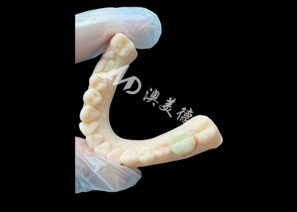 High Strength Ceramic Zirconia Posterior Dental Crown Superior Aesthetic and