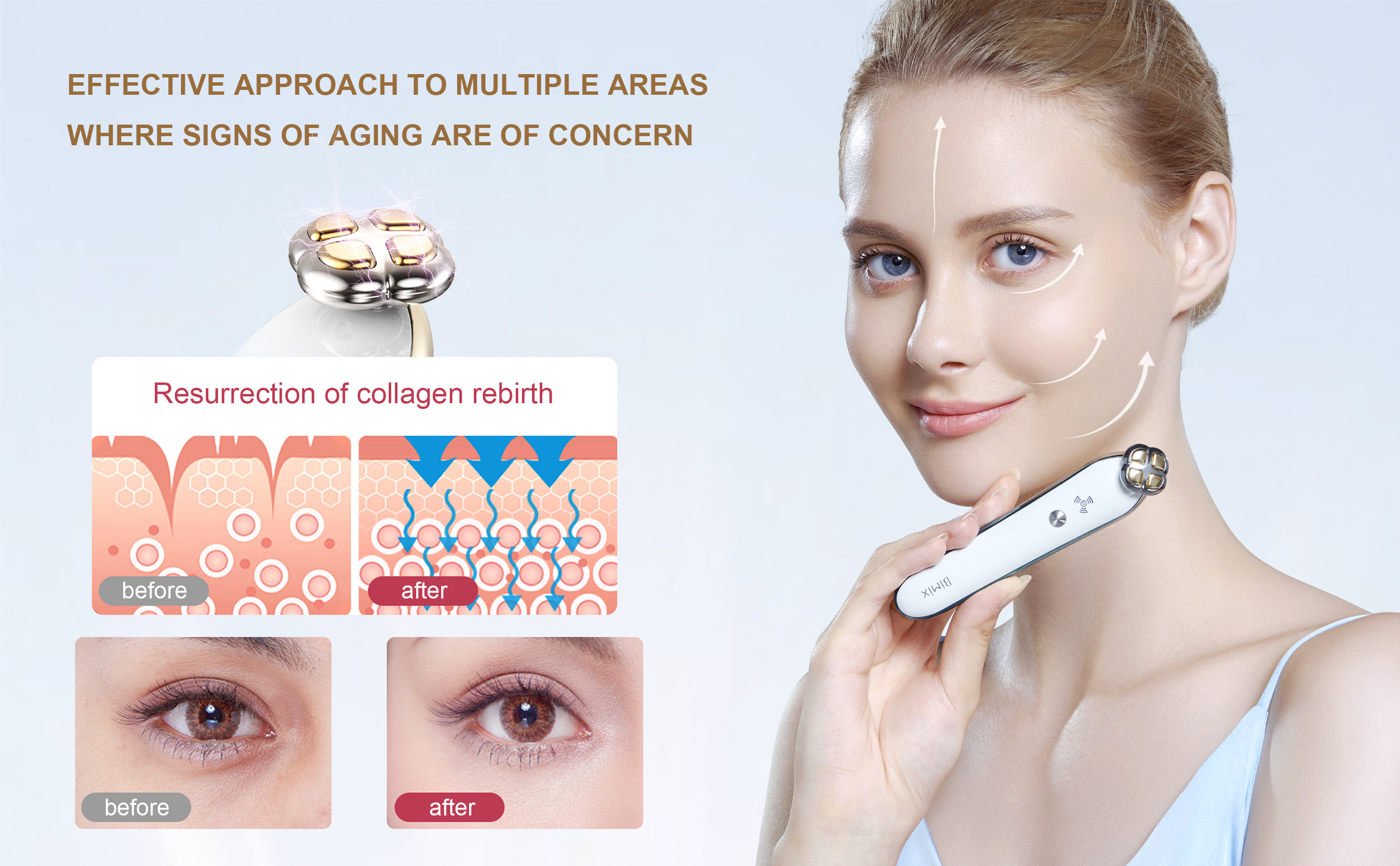 RF 300KHz Eye Beauty Device
