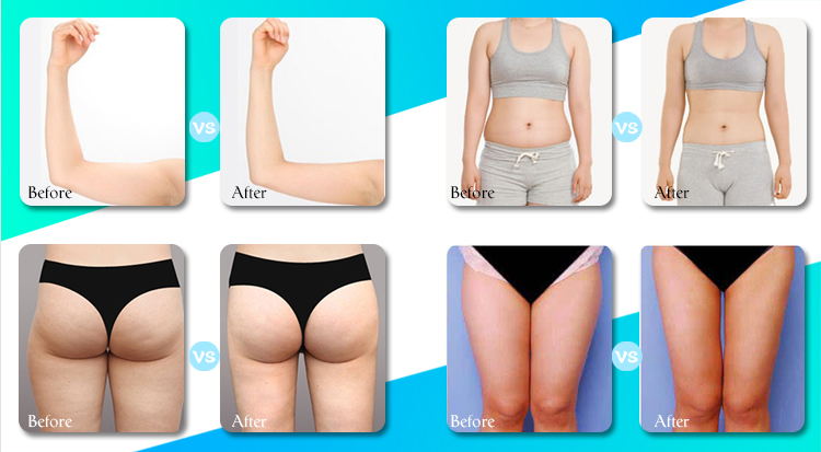 Portable Cavitation Vacuum Machine , Body Shaping Cavitation Vacuum Slimming Machine