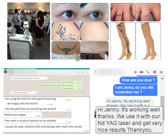 new product 2018 double rod nd yag laser tattoo removal machine 1064nm 532nm birth mark remove