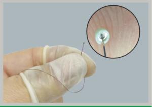  High Precision micro welding medical device for OEM contract manufacturing Manufactures