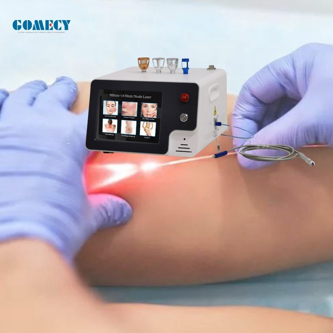EVLT Varicose Vein Removal Machine Radial Fiber Laser EVLT Endovenous Ablation Treatment Machine