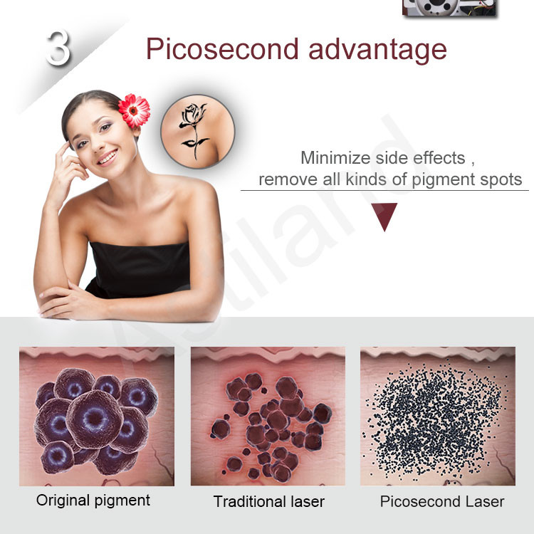 Tattoo Removal Skin Rejuvenation Picosecond Laser For Skin Tightening Beauty Salon
