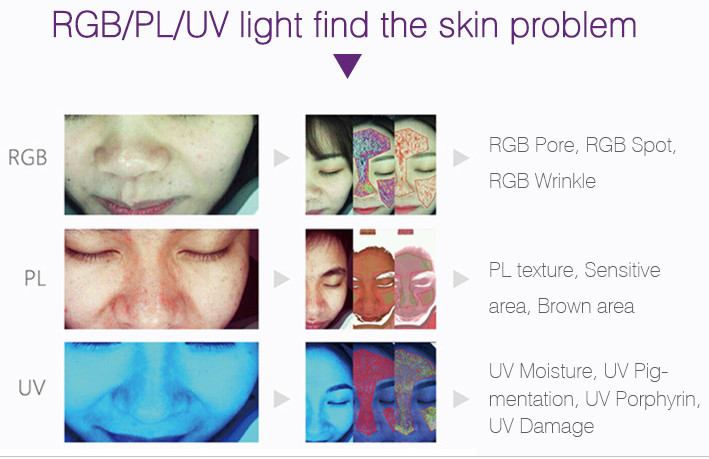 Android System Skin Analysis Machine Salon Big Data Base 3D Testing Facial