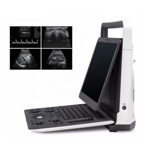 High Quality Ultrasonic SonoScape E2 with Ultrasonic Sensors