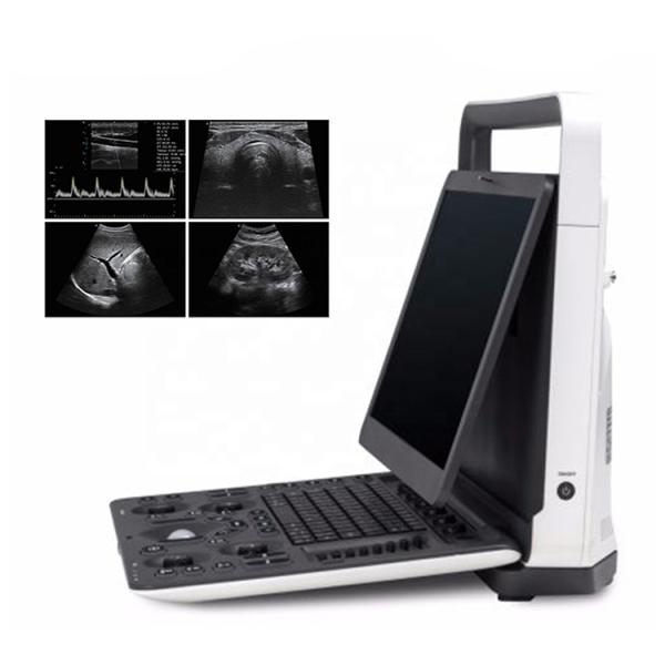 Quality High Quality Ultrasonic SonoScape E2 with Ultrasonic Sensors for sale