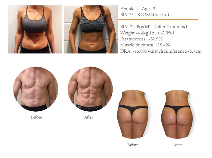 Ems Machine Price Ems Muscle Body Sculpt Machine / RF Electromagnetic Body Ems Sculpting Machine