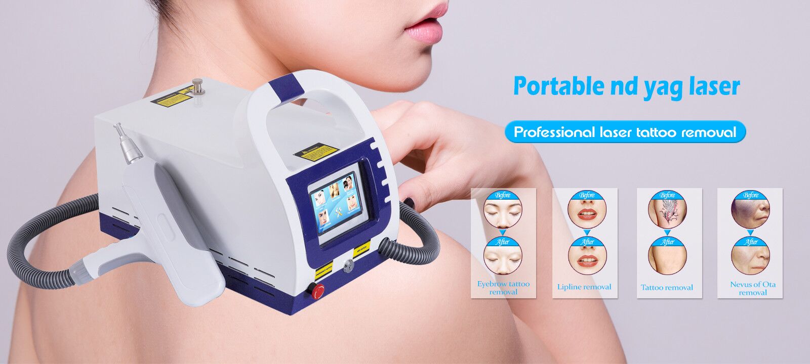 Q Switch Nd Yag Laser Machine Tattoo Removal Skin Rejuvenation 1000mj Energy
