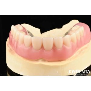 Firmly Connect Row Teeth Elaborate Technology Framework Set Up Teeth Finish For