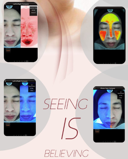 The Fifth Generation Magic Mirror Intelligent Skin Analyzer for spa clinic and hospital using white golden color CE FCC