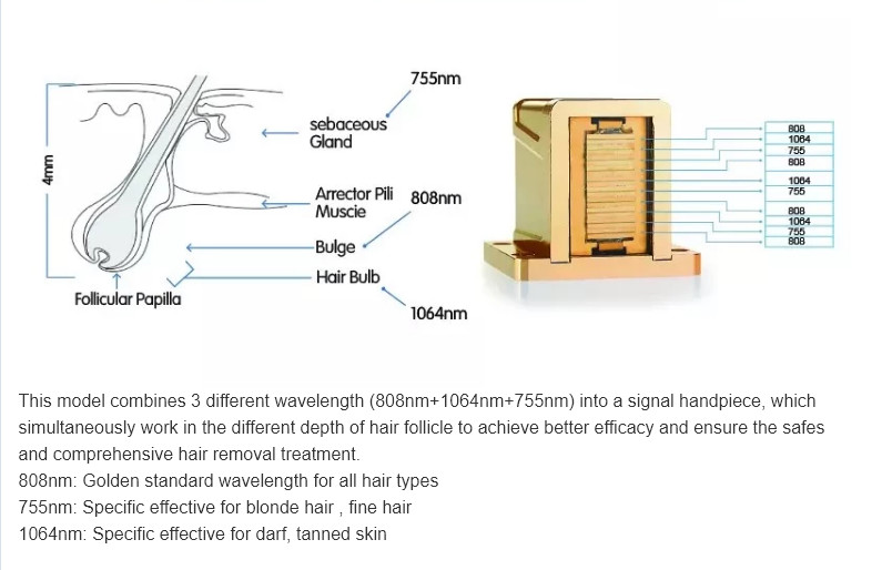 755nm 808nm 1064nm soprano laser hair removal device machine/portable diode laser hair removal machine