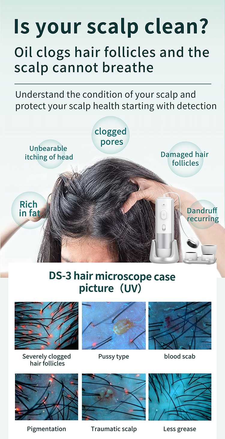 16 Million HD Lenses Skin Hair Analyzer Machine For Head Revitalization